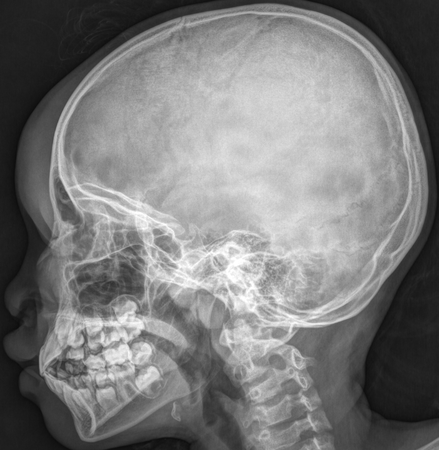 x-rays